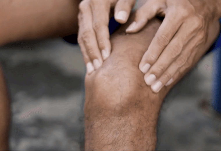 Dolor crónico en la rodilla: mitos y verdades que debes conocer 